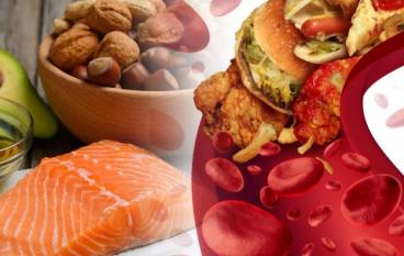 Как понизить уровень холестерина в крови?